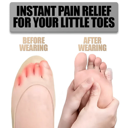 Silicone Toe Protectors with Friction Reducing Cushioning, Medical Grade and Latex Free All Vera Mart