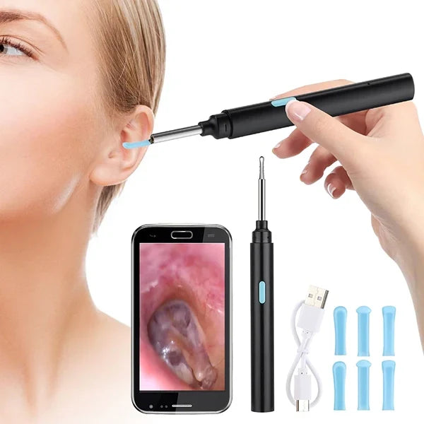 Ear Canal Camera with 20X Magnification and Spoon Tip Attachment, Wireless App