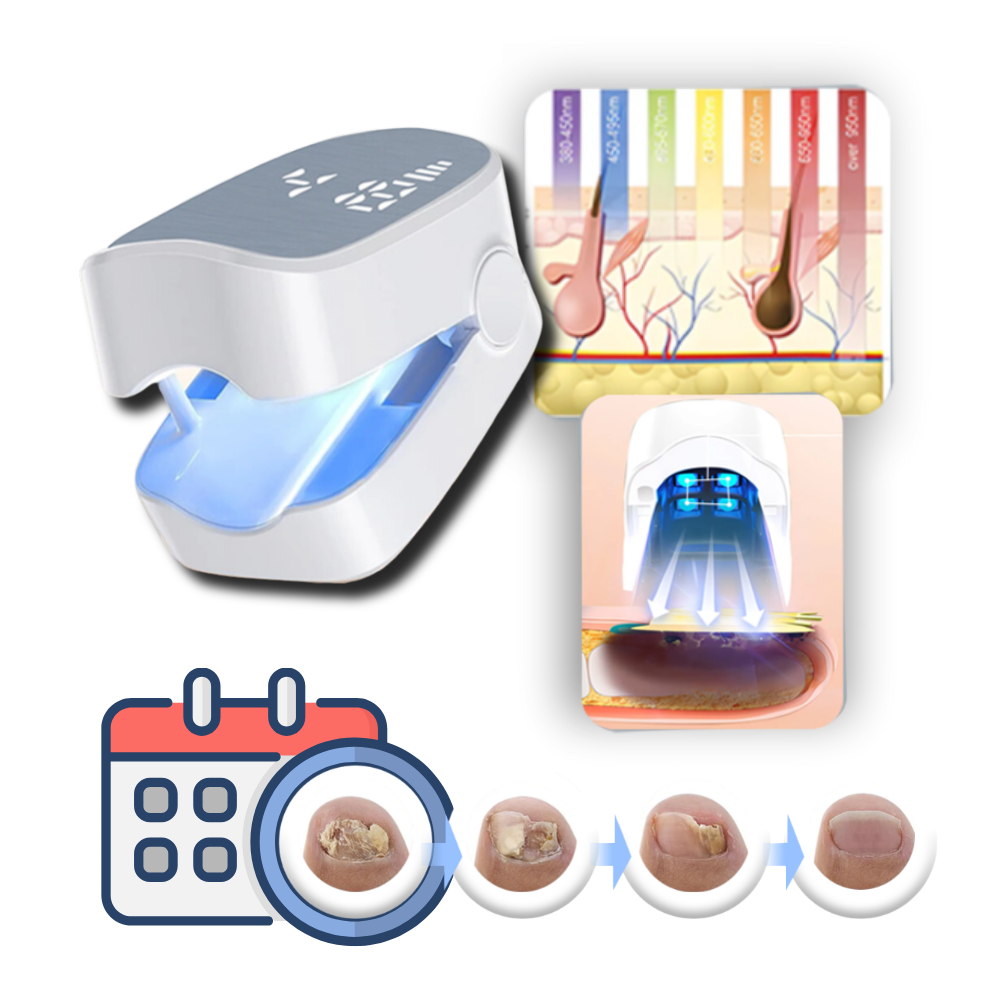 Dual Laser Nail Treatment Device with Blue Light and Pulsed Mode, 7-Minute Sessions