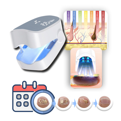 Dual Laser Nail Treatment Device with Blue Light and Pulsed Mode, 7-Minute Sessions