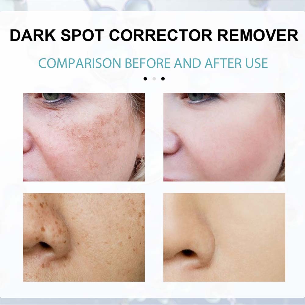 Dark Spot Facial Cream with Nicotinamide and Moisturizing Base for All Skin Types