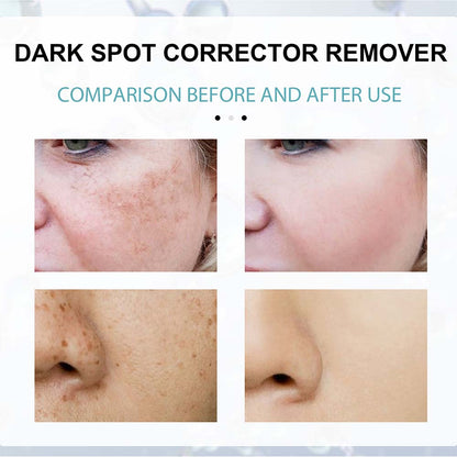Dark Spot Facial Cream with Nicotinamide and Moisturizing Base for All Skin Types