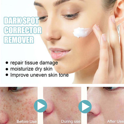 Dark Spot Facial Cream with Nicotinamide and Moisturizing Base for All Skin Types