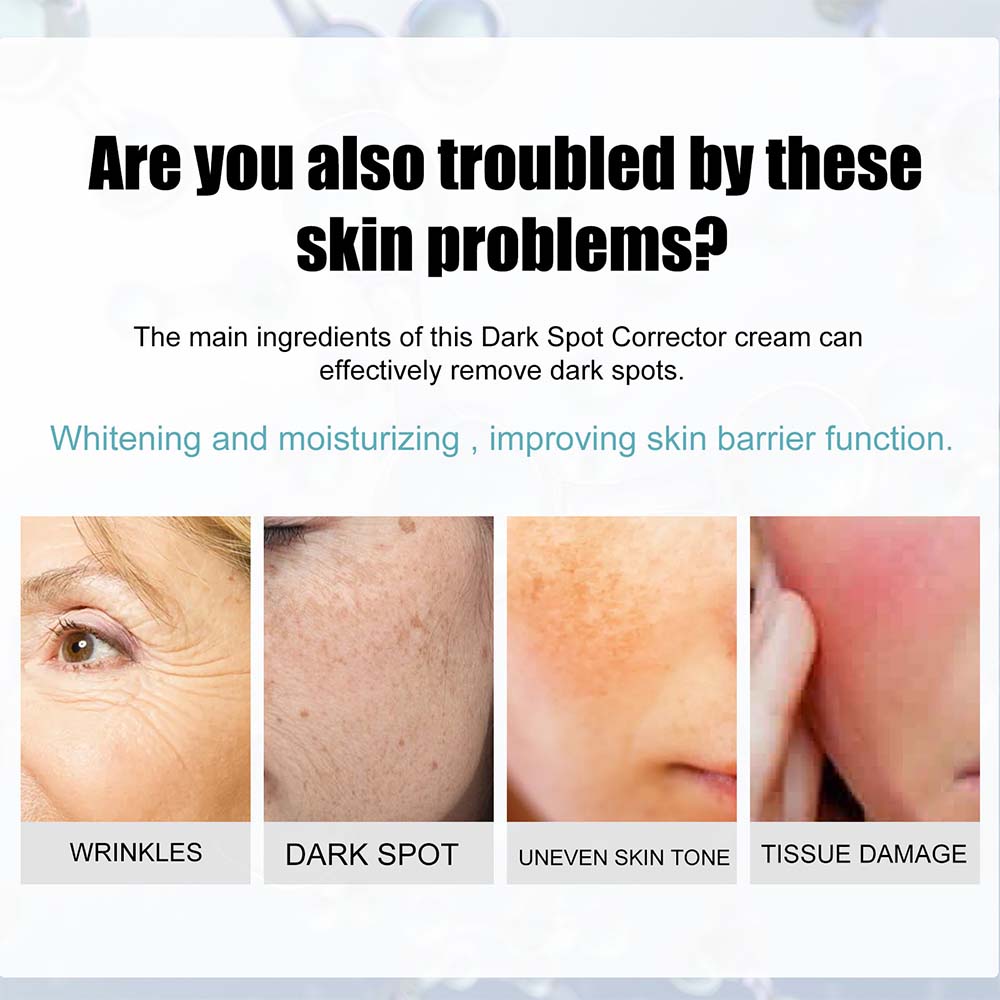 Dark Spot Facial Cream with Nicotinamide and Moisturizing Base for All Skin Types