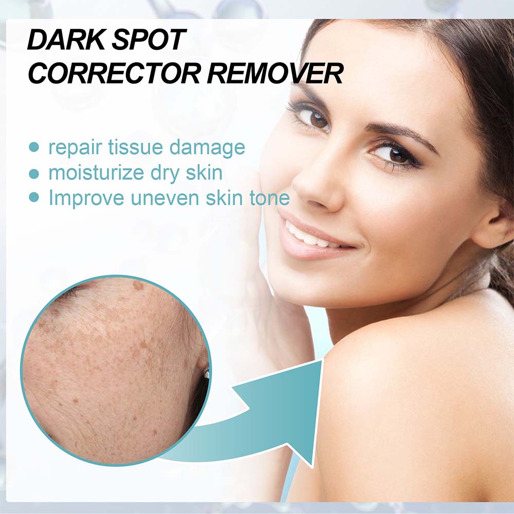 Dark Spot Facial Cream with Nicotinamide and Moisturizing Base for All Skin Types