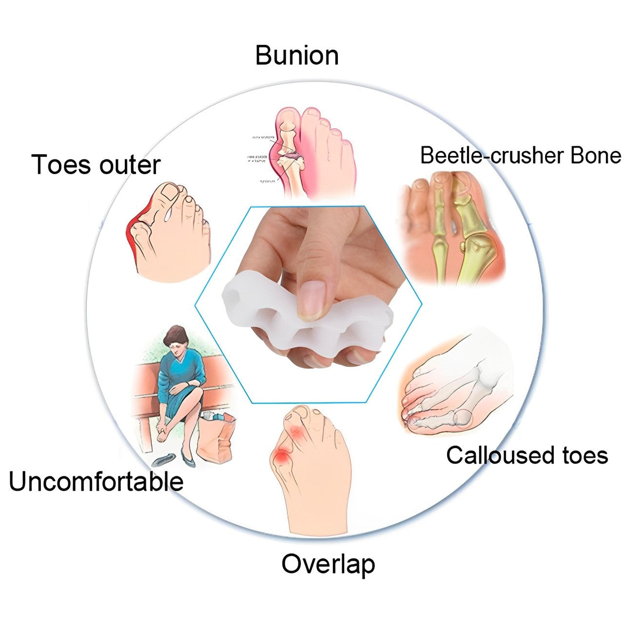 Toe Splint Brace with Adjustable Straps and Breathable Design for Alignment