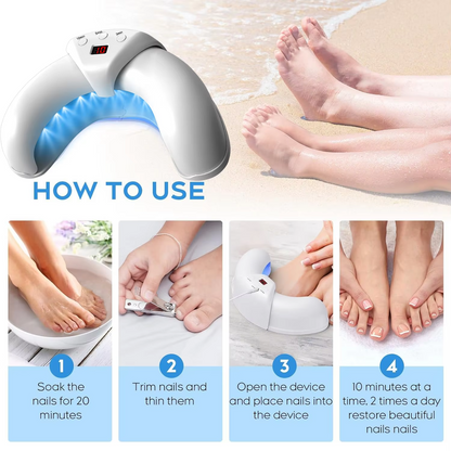 Rechargeable Laser Nail Treatment Device with Focused Light Wavelengths for Fungus