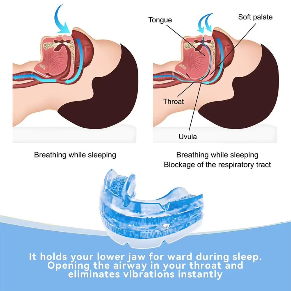 Oral Jaw Advancement Device with Multi-Position Adjustment for Sleep Apnea