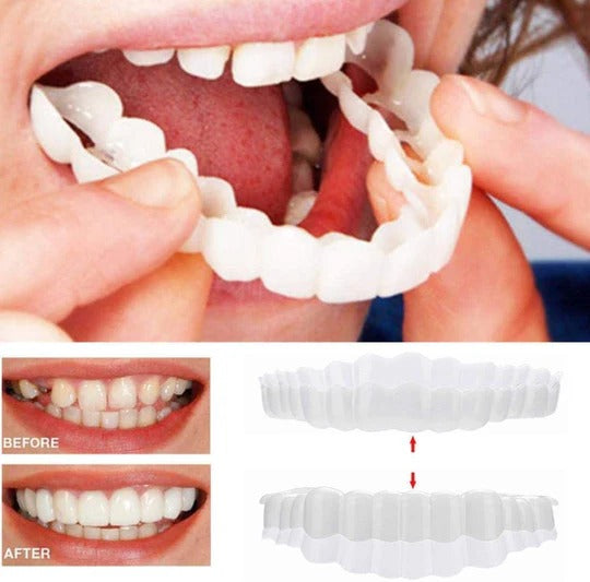 Cosmetic Tooth Cover with Moldable Insert for Upper and Lower Teeth